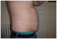 abdomen-before-1